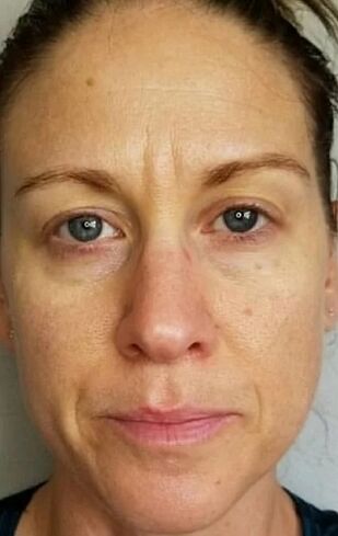 At the age of 40, deep wrinkles and points of age appeared