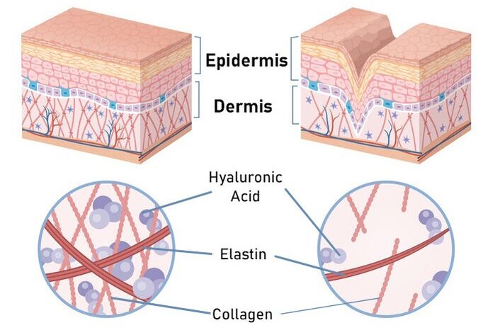 Simple 360 ​​stimulates collagen synthesis